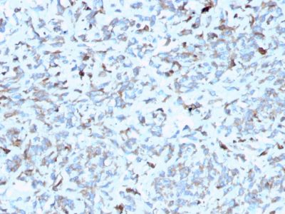 C1QA / Complement C1q A-Chain Monoclonal Mouse Antibody (C1QA/2952)