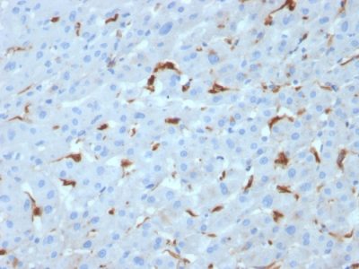 C1QA / Complement C1q A-Chain Monoclonal Mouse Antibody (C1QA/2953)