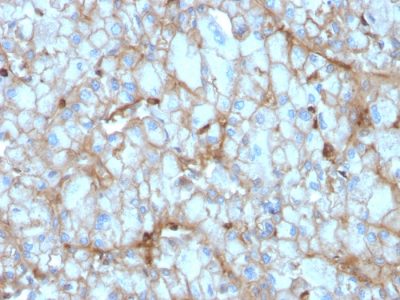 C1QA / Complement C1q A-Chain Monoclonal Mouse Antibody (C1QA/2954)