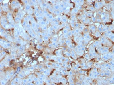 C1QA / Complement C1q A-Chain Monoclonal Mouse Antibody (C1QA/2955)