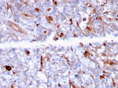 C1QA / Complement C1q A-Chain Monoclonal Mouse Antibody (C1QA/2956)