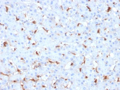 C1QB / Complement C1q B-Chain Monoclonal Mouse Antibody (C1QB/2961)