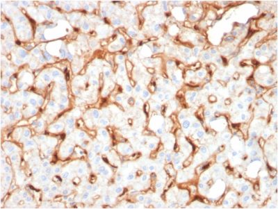 C1QB / Complement C1q B-Chain Monoclonal Mouse Antibody (C1QB/2965)