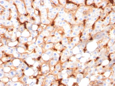 C1QB / Complement C1q B-Chain Monoclonal Mouse Antibody (C1QB/2966)