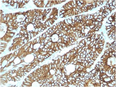 Cadherin 17 / LI Cadherin Monoclonal Mouse Antibody (CDH17/2615)