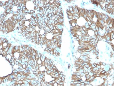 Cadherin 17 / LI Cadherin Monoclonal Mouse Antibody (CDH17/2616)