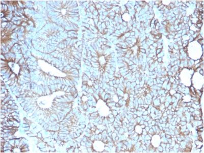 Cadherin 17 / LI Cadherin Monoclonal Mouse Antibody (CDH17/2617)