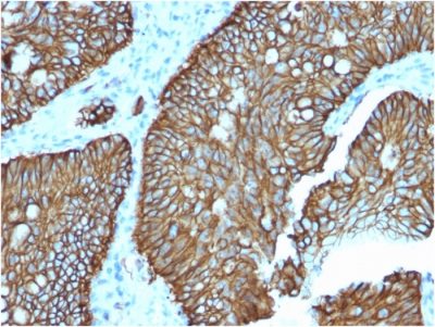 Cadherin 17 / LI Cadherin Monoclonal Mouse Antibody (CDH17/2618)