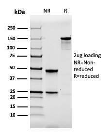Calbindin 1 Monoclonal Mouse Antibody (CALB1/2364)