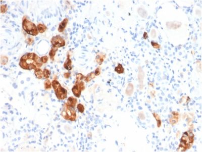 Calbindin 1 Monoclonal Mouse Antibody (CALB1/2782)