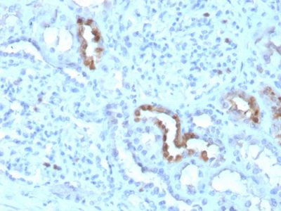 Calbindin 1 Monoclonal Mouse Antibody (CALB1/3333)