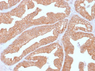 Calcineurin A / PPP3CA Monoclonal Mouse Antibody (CALNA/2353)