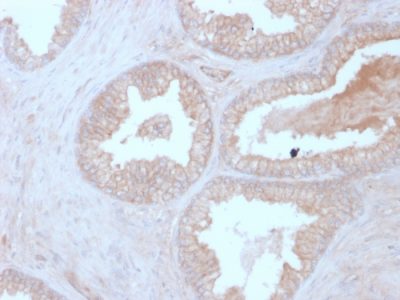 Calcineurin B / PPP3R1 Monoclonal Mouse Antibody (CALNB/2342)