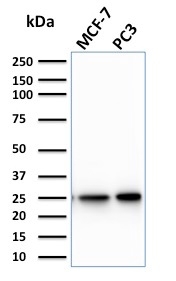 Calcineurin B homologous protein 2 / HCC Antigen 520 Monoclonal Mouse Antibody (CPTC-CHP2-1)