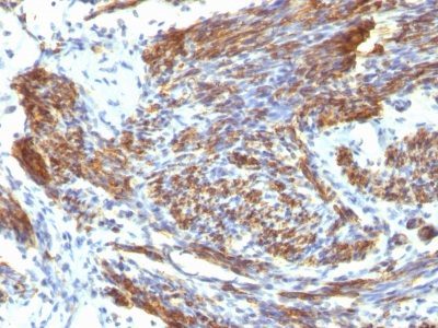 Caldesmon, HMW Monoclonal Mouse Antibody (CALD1/820)