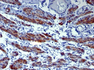 Caldesmon, HMW Monoclonal Mouse Antibody (h-CALD)