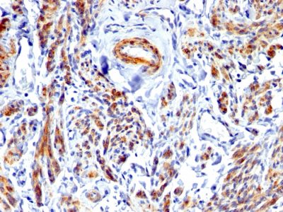 Caldesmon, HMW Polyclonal Rabbit Antibody