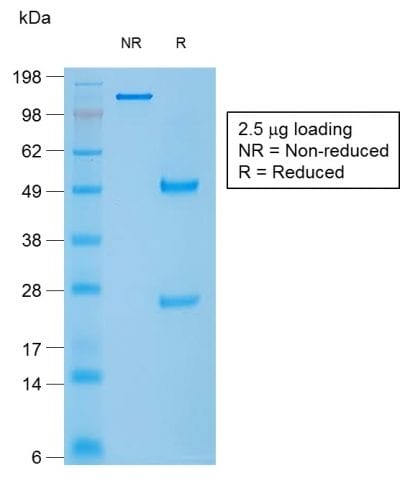 Caldesmon, HMW Recombinant Monoclonal Mouse Antibody (rCALD1/820)