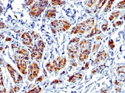 Caldesmon, HMW Recombinant Monoclonal Rabbit Antibody (CALD1/1424R)