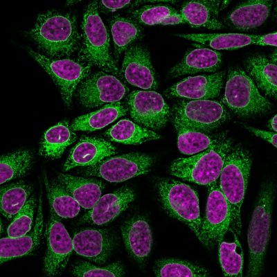 Calnexin Monoclonal Mouse Antibody (CANX/1541)