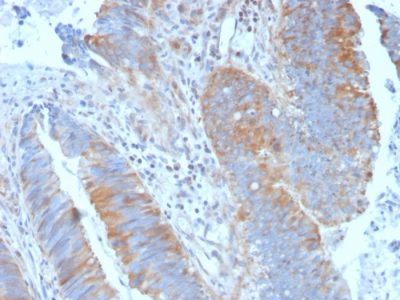 Calpain 1 Monoclonal Mouse Antibody (CAPN1/1530)