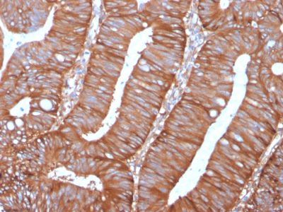 Calpastatin Monoclonal Mouse Antibody (CAST/1550)