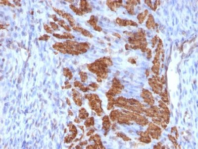 Calponin-1 Monoclonal Mouse Antibody (CALP + CNN1/832)
