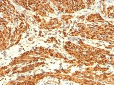 Calponin-1 Monoclonal Mouse Antibody (CALP + CNN1/832)