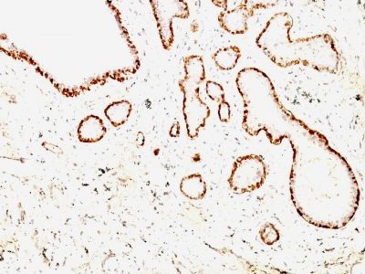 Calponin-1 Monoclonal Mouse Antibody (CALP + CNN1/832)