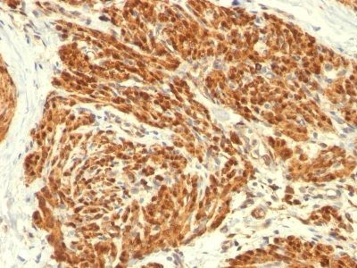 Calponin-1 Monoclonal Mouse Antibody (CALP)