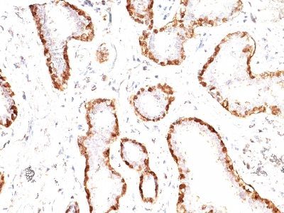 Calponin-1 Monoclonal Mouse Antibody (CNN1/832)