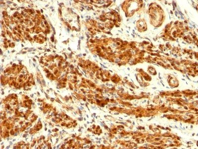 Calponin-1 Monoclonal Mouse Antibody (CNN1/832)