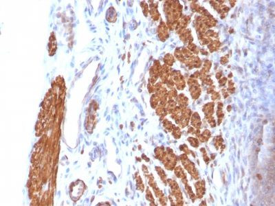 Calponin-1 Monoclonal Mouse Antibody (CNN1/832)