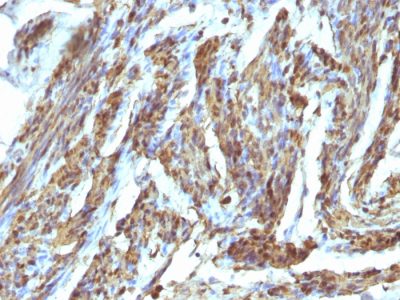 Calponin-1 Polyclonal Rabbit Antibody