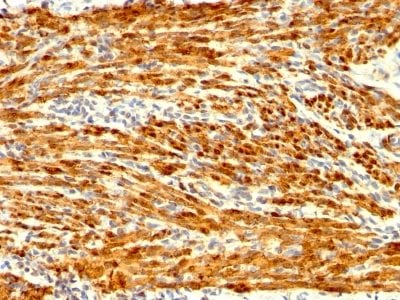 Calponin-1 Recombinant Monoclonal Rabbit Antibody (CNN1/1408R)