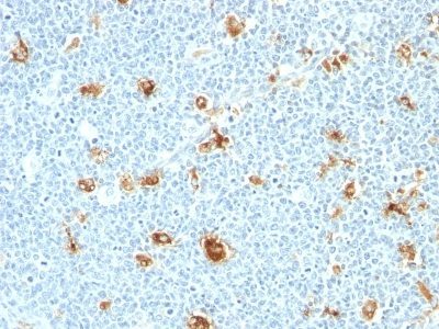 Calprotectin / Protein S100-A9 Monoclonal Mouse Antibody (CAGB/426)