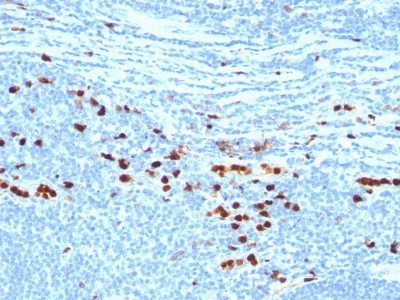 Calprotectin / Protein S100-A9 Monoclonal Mouse Antibody (CAGB/426)