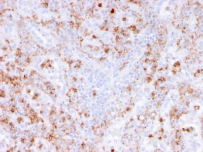 Calprotectin / Protein S100-A9 Monoclonal Mouse Antibody (CAGB/426)