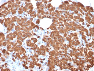 Carboxypeptidase A1 Monoclonal Mouse Antibody (CPA1/2711)