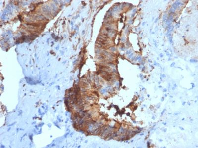 Cathepsin D Monoclonal Mouse Antibody (CTSD/2781)