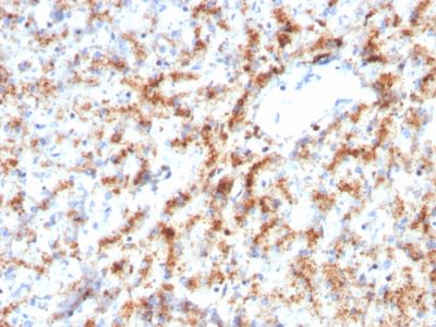 Cathepsin D Monoclonal Mouse Antibody (CTSD/3082)