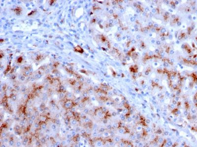 Cathepsin D Monoclonal Mouse Antibody (CTSD/3083)