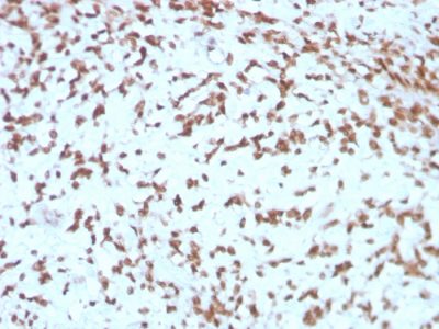 Cathepsin D Monoclonal Mouse Antibody (CTSD/3275)