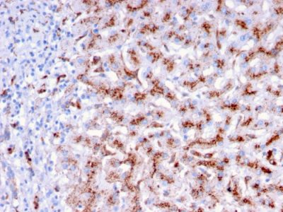 Cathepsin D Monoclonal Mouse Antibody (CTSD/3276)