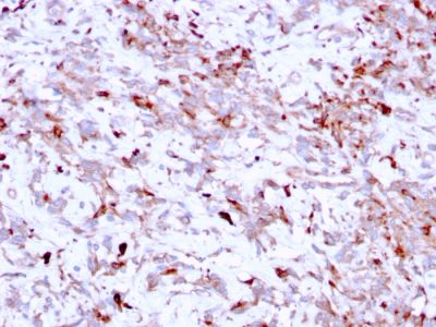 Cathepsin K Monoclonal Mouse Antibody (CTSK/2791)