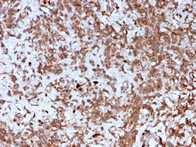 Cathepsin K Monoclonal Mouse Antibody (CTSK/2792)