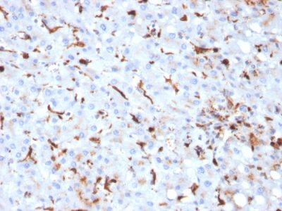 Cathepsin K Monoclonal Mouse Antibody (CTSK/2793)
