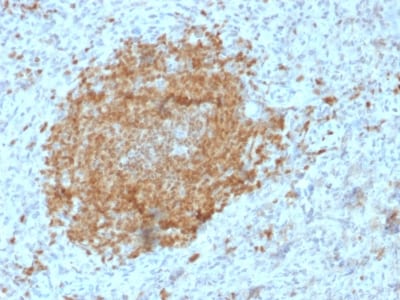 BOB-1 Monoclonal Mouse Antibody (BOB1/2425)