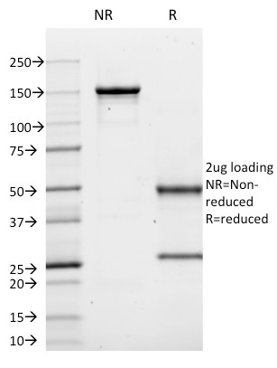 CD10 Monoclonal Mouse Antibody (MME/1620)