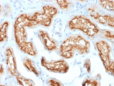 CD10 Monoclonal Mouse Antibody (MME/1870)